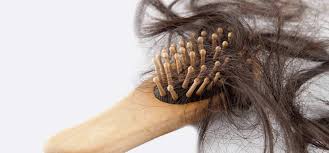 Hasil gambar untuk Hair Loss