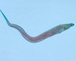 Image of Pinworm