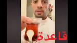 أخصائي: أكل "النشويات البيضاء" جريمة