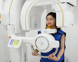 Image of Chụp CT Cone Beam nha khoa