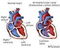 Myocardial Infarction (MI) Quick Reference
