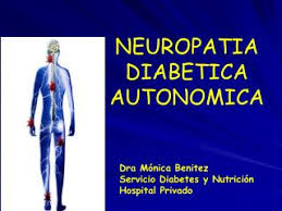 Image result for neuropatia diabetike