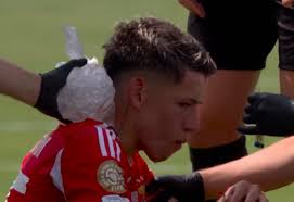 Bayern vs Benfica: Heatstroke Drama and World Cup Club Prep! - Imagen principal del artículo