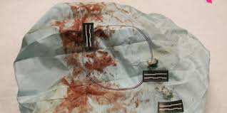 Image result for takata recall