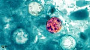 'Large and growing' parasitic infection outbreak spreading in Michigan, health officials say