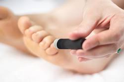 Image result for moxibustion breech baby