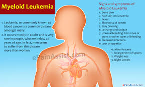 Image result for leukemia