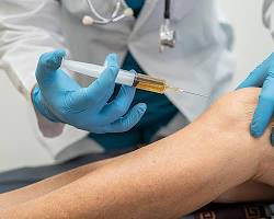 Image of PlateletRich Plasma (PRP) Therapy treatment