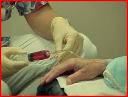 Résultat de recherche d'images pour '‫اسباب سرطان الرحم واعراضه‬‎'