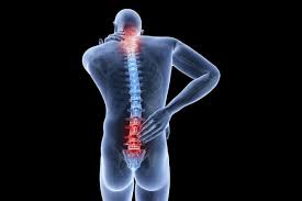 Imagini pentru hernie de disc