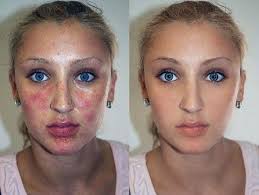 before after photoshop