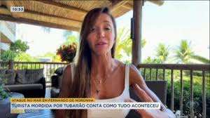 Turista é atacada por tubarão durante mergulho em Fernando de Noronha