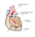 Was ist eine Herzmuskel- oder Herzbeutelentzündung? TK