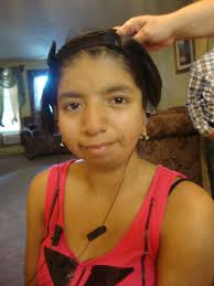 Meet sweet Laura Lopez. Laura is from Salem, Oregon (United States) and is a Spanish speaking 13 year old who was born with bilateral Microtia and Atresia. - Laura-head-shota