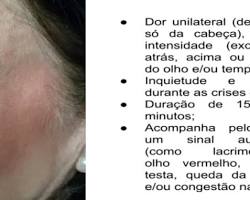 Imagem de Causas da Cefaleia em salvas