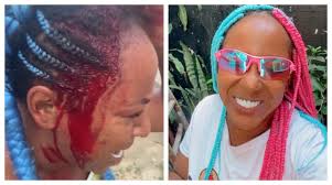 Cantora de funk diz ter sido agredida com pauladas pelo namorado MC em SP