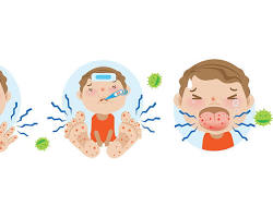 Image of child with hand, foot, and mouth disease