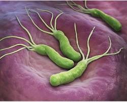 Helicobacter pylori bacteriaの画像