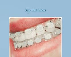 Image of Sáp tiện nha khoa