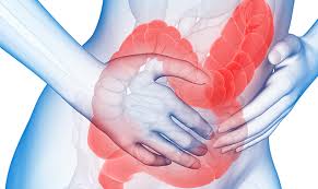 Hasil gambar untuk Irritable Bowel Syndrome (IBS).