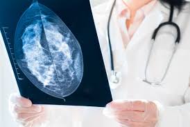 Groundbreaking Breast Cancer Breakthrough Unveiled by Liverpool Scientists - 1