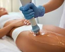 Image of different cellulite treatment techniques