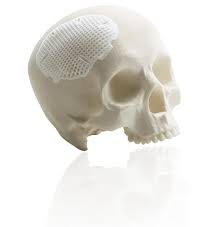 Lithoz Ceramic 3d Printing Technology | Objective 3D