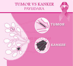 Image result for kanker