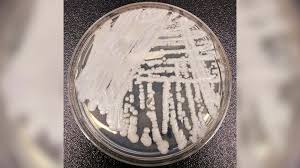 The Fungus Among Us: Understanding the Spread and Risks of a Deadly Fungal Infection in the US