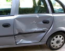 Resultado de imagen de dented