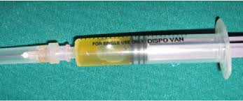 Syringe containing straw colored fluid on aspiration ...