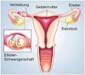 Eileiterschwangerschaft, Bauchhöhlenschwangerschaft