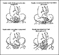 Hasil gambar untuk macam macam hodge