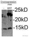 Structural Dynamics of Green Fluorescent Protein Alone and Fused