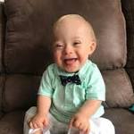  New Gerber baby is the first ever with Down syndrome