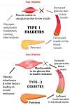 Diabetes type 1 og 2