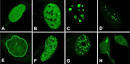 Cyto- and chemoarchitecture of the hypothalamic paraventricular
