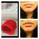 Lip enhancer reviews