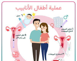 صورة الأنابيب