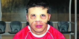 José Luis Bazán con la máscara que no le autorizan. :: PACO ESPADAS - 13223511