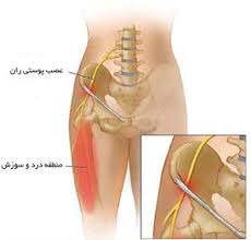Image result for ‫باسن و ران‬‎