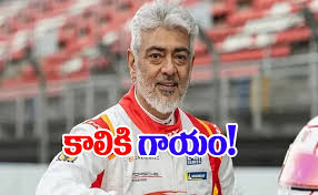 Ajith Kumar Leg Injury: అభిమానుల అత్యుత్సాహం.. ఆస్పత్రిలో కోలీవుడ్ స్టార్ అజిత్ కుమార్