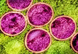 Mpox Evolution Raises Alarms Over Potential Global Resurgence