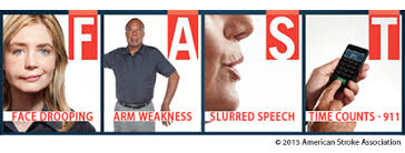 Image result for stroke