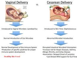 Image result for delivery baby