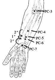 Image result for acupressure P6 image