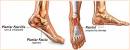 Maladies orthopdiques - Principales maladies des pieds - Doctissimo