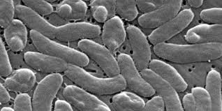 5 dead, 4 hospitalized from flesh-eating bacteria outbreak, health officials say