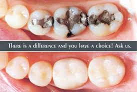 Dental Fillings, Composite, Amalgam, Porcelain, Tempe, Chandler, Mesa, Phoenix, Gilbert, Arizona