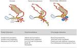 Anal incontinence and Quality of Life in late pregnancy: a